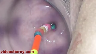 Uterus Nadir thoroughly with Objects, Pumping Cervix Prolapse